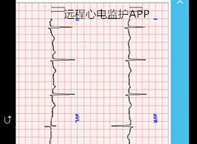 远程心电监护软件开发功能特点