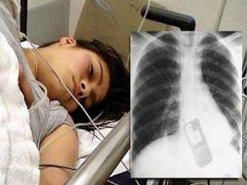 奇葩女子吞下手机的惊人之举