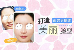 医美app软件开发该这样解决问题 