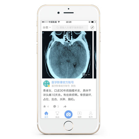 医疗影像APP开发